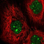 Immunofluorescent staining of human cell line A-431 shows localization to nucleus & nucleoli.