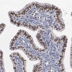 Immunohistochemical staining of human Fallopian tube shows strong nuclear positivity in glandular cells.