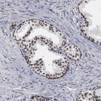 Anti-TRMT5 Antibody