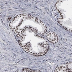 Immunohistochemical staining of human prostate shows strong nuclear positivity in glandular cells.