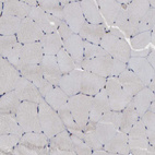 Immunohistochemical staining of human skeletal muscle shows no positivity in myocytes as expected.