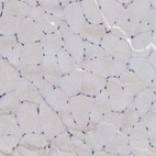 Immunohistochemical staining of human skeletal muscle shows no positivity in myocytes as expected.