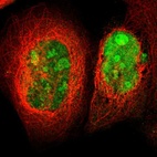 Anti-TRMT5 Antibody