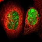 Immunofluorescent staining of human cell line A-431 shows localization to nucleus & nucleoli.
