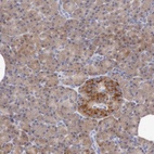 Anti-ANGEL1 Antibody