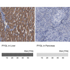 Anti-PYGL Antibody