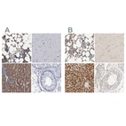 Immunohistochemical staining of human bone marrow, cerebral cortex, liver and testis using Anti-PYGL antibody HPA000962 (A) shows similar protein distribution across tissues to independent antibody HPA004119 (B).