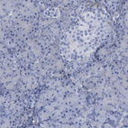 Anti-PYGL Antibody