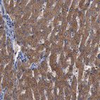 Immunohistochemical staining of human liver shows strong cytoplasmic positivity in hepatocytes.
