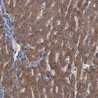 Immunohistochemical staining of human liver shows strong cytoplasmic positivity in hepatocytes.