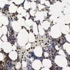 Immunohistochemical staining of human bone marrow shows strong cytoplasmic positivity in hematopoietic cells.
