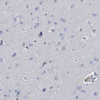 Immunohistochemical staining of human cerebral cortex shows no positivity in neurons.