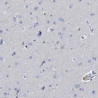 Immunohistochemical staining of human cerebral cortex shows no positivity in neurons.