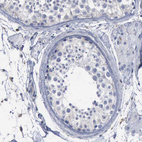 Immunohistochemical staining of human testis shows no positivity in cells in seminiferous ducts.