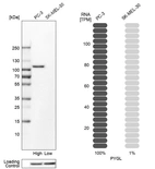 Western blot analysis in human cell lines PC-3 and SK-MEL-30 using Anti-PYGL antibody. Corresponding PYGL RNA-seq data are presented for the same cell lines. Loading control: Anti-HSP90B1.