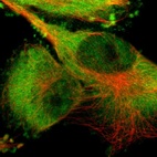 Anti-PYGL Antibody