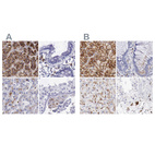 Immunohistochemical staining of human adrenal gland, colon, liver and testis using Anti-GLA antibody HPA000966 (A) shows similar protein distribution across tissues to independent antibody HPA000237 (B).