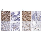 Immunohistochemical staining of human adrenal gland, colon, liver and testis using Anti-GLA antibody HPA000966 (A) shows similar protein distribution across tissues to independent antibody HPA000237 (B).