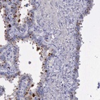Immunohistochemical staining of human seminal vesicle shows high expression.