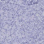 Immunohistochemical staining of human pancreas shows low expression as expected.