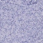 Immunohistochemical staining of human pancreas shows low expression as expected.