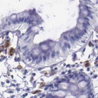 Immunohistochemical staining of human colon using Anti-GLA antibody HPA000966.