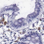 Immunohistochemical staining of human colon using Anti-GLA antibody HPA000966.