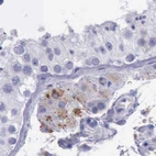 Immunohistochemical staining of human testis using Anti-GLA antibody HPA000966.