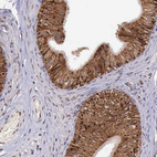 Anti-ARMCX3 Antibody