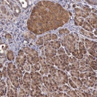 Immunohistochemical staining of human pancreas shows strong cytoplasmic positivity in exocrine glandular cells.