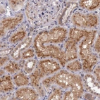 Immunohistochemical staining of human kidney shows strong cytoplasmic positivity in cells in tubules.