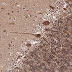 Immunohistochemical staining of human cerebellum shows strong cytoplasmic positivity in Purkinje cells.