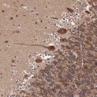 Immunohistochemical staining of human cerebellum shows strong cytoplasmic positivity in Purkinje cells.