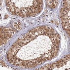 Immunohistochemical staining of human testis shows strong cytoplasmic positivity in cells in seminiferous ducts.