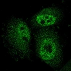 Immunofluorescent staining of human cell line U-251 MG shows localization to nucleoplasm & cytosol.