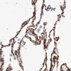 Immunohistochemical staining of human lung shows strong cytoplasmic positivity in pneumocytes.