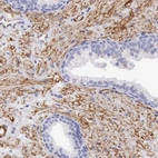 Immunohistochemical staining of human prostate shows moderate membranous positivity in smooth muscle cells.