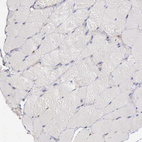 Immunohistochemical staining of human skeletal muscle shows no positivity in myocytes as expected.