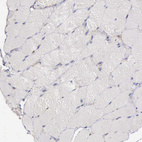 Anti-AOC3 Antibody