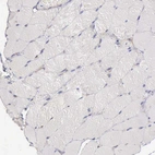 Immunohistochemical staining of human skeletal muscle shows no positivity in myocytes as expected.