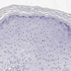Immunohistochemical staining of human skin shows no positivity in squamous epithelial cells as expected.