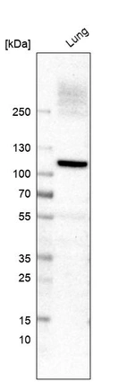 Western blot analysis in human lung tissue.