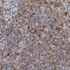 Anti-STAT1 Antibody