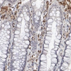 Immunohistochemical staining of human rectum shows moderate cytoplasmic positivity in lymphoid cells.