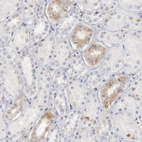 Anti-STAT1 Antibody