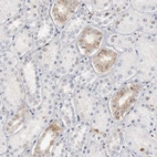 Immunohistochemical staining of human kidney shows weak cytoplasmic positivity in cells in distal tubules.