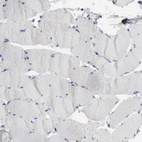 Immunohistochemical staining of human skeletal muscle shows no positivity in a subset of myocytes as expected.