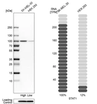Western blot analysis in human cell lines SK-MEL-30 and HEK293 using Anti-STAT1 antibody. Corresponding STAT1 RNA-seq data are presented for the same cell lines. Loading control: Anti-PFN1.