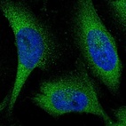 Anti-KLHL28 Antibody