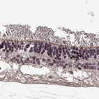 Immunohistochemical staining of human eye, retina using Anti-MPP5 antibody HPA000993.